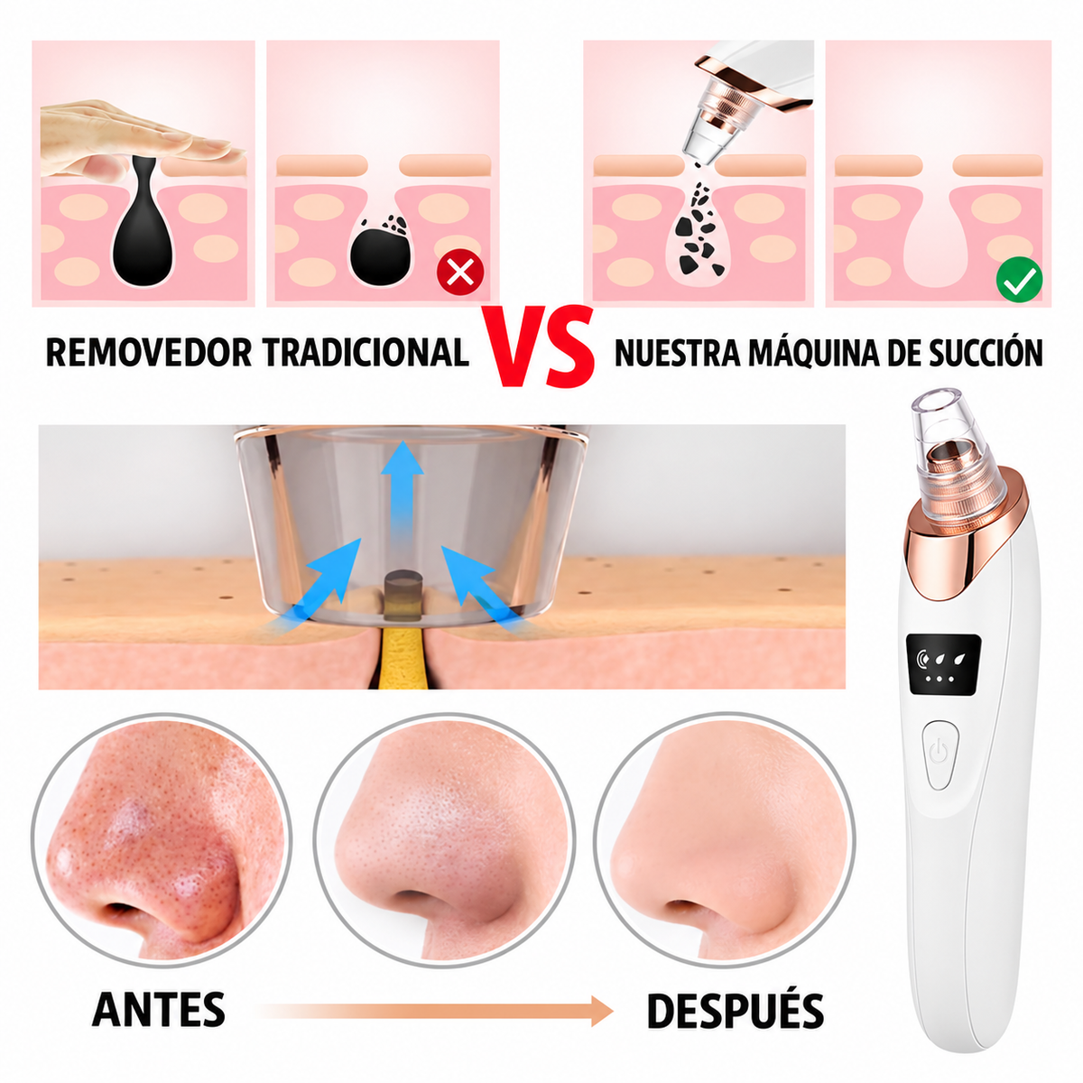 ESPURE Removedor de Puntos Negros Facial